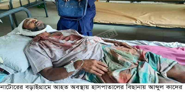 বড়াইগ্রামে জমি নিয়ে বিরোধে ভাইয়ের রডের আঘাতে রক্তাক্ত ভাই!